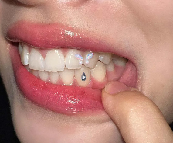 Is Tooth Jewelry safe?
