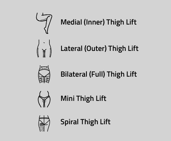 Types of Thigh Lifts