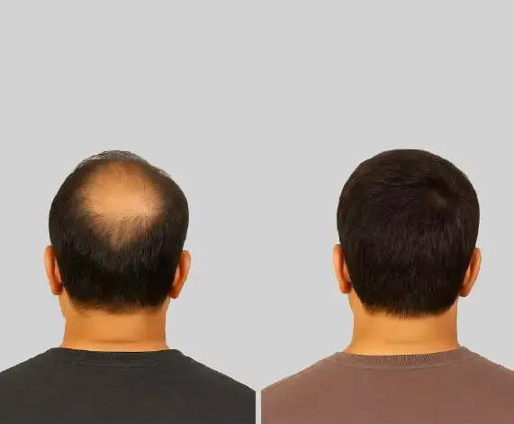 Are the results of PRP guaranteed?